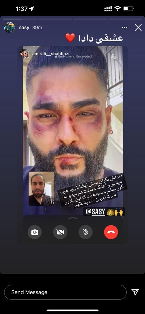 کتک خوردن ساسی مانکن بخاطر یک دختر/عکس