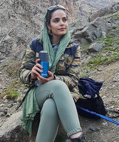 عمل زیبایی سپیده خداوردی فاجعه بار شد/ عکس