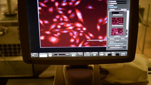 ۳ سرطانی که ممکن است در آینده از بین بروند سرطان