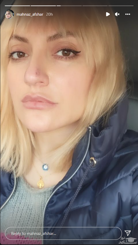 زخم بهبود نیافته صورت مهناز افشار/عکس