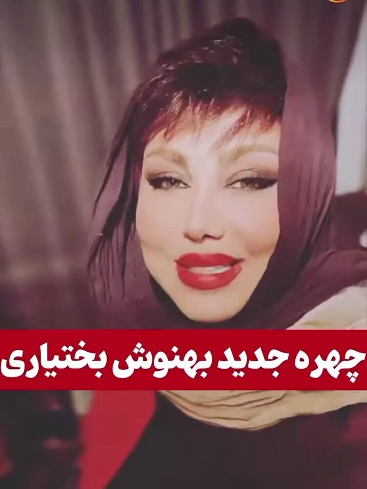 عکس چهره جدید بهنوش بختیاری پس از عمل زیبایی عکس چهره جدید بهنوش بختیاری پس از عمل زیبایی