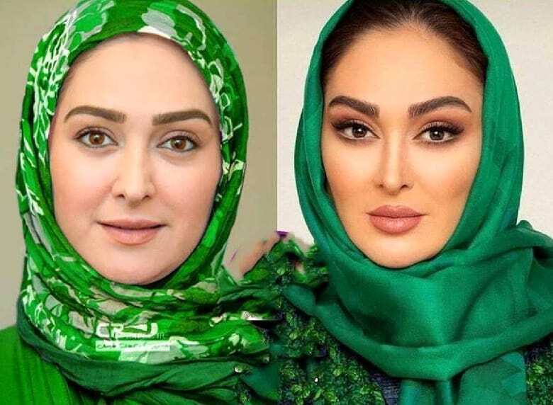 تغییر عجیب فیس الهام حمیدی با عمل زیبایی+ عکس