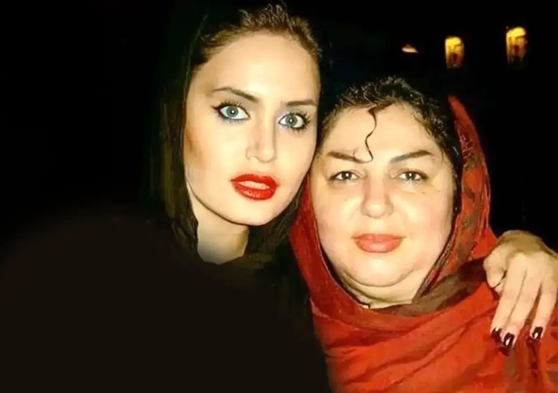 تفاوت عجیب چهره الناز شاکردوست با مادرش+ عکس