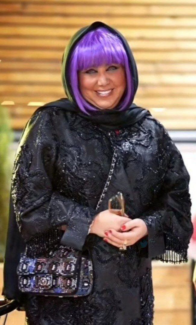 سوژه شدن تغییر چهره عجیب بهنوش بختیاری/ عکس