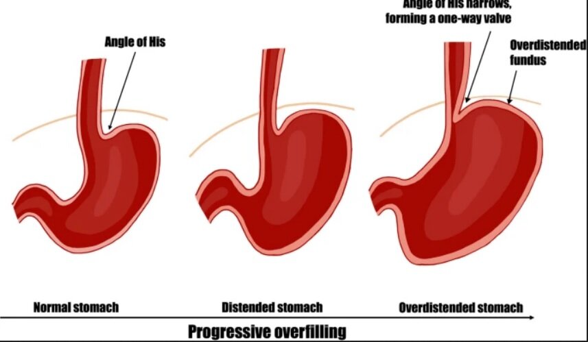 معده بعد از صرف غذا تا چقدر منبسط میشود؟